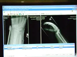 xray1.webp