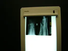 xray3.webp