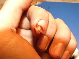 finger5.webp